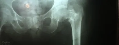 La imagen 2 de la Empresa RAYOS X Salud y Medicina en Ciudad De México CMX